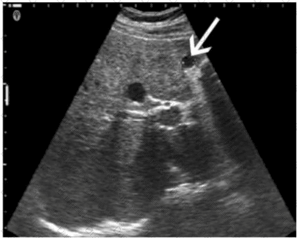 AB-Abdomen Question 40
