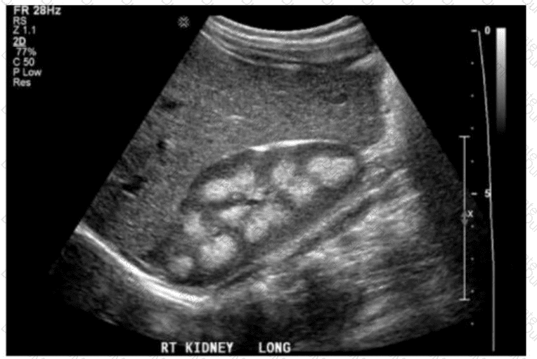 AB-Abdomen Question 28