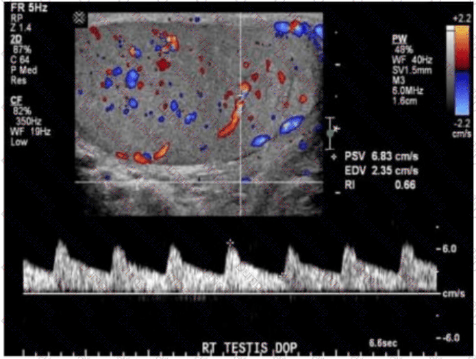 AB-Abdomen Question 15