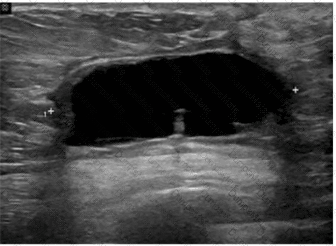 AB-Abdomen Question 4