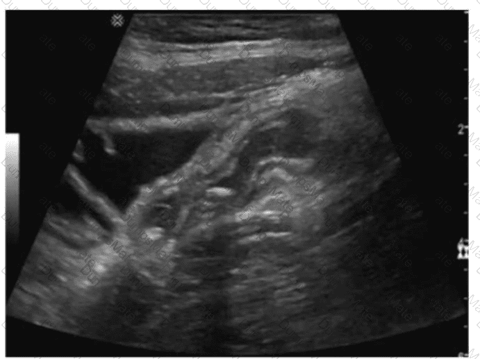 AB-Abdomen Question 10