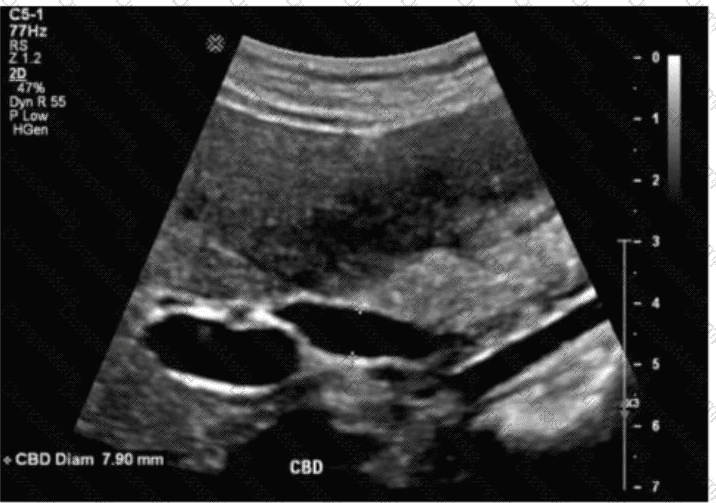 AB-Abdomen Question 10