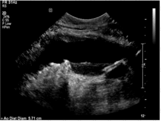 AB-Abdomen Question 46