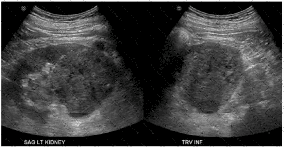 AB-Abdomen Question 8