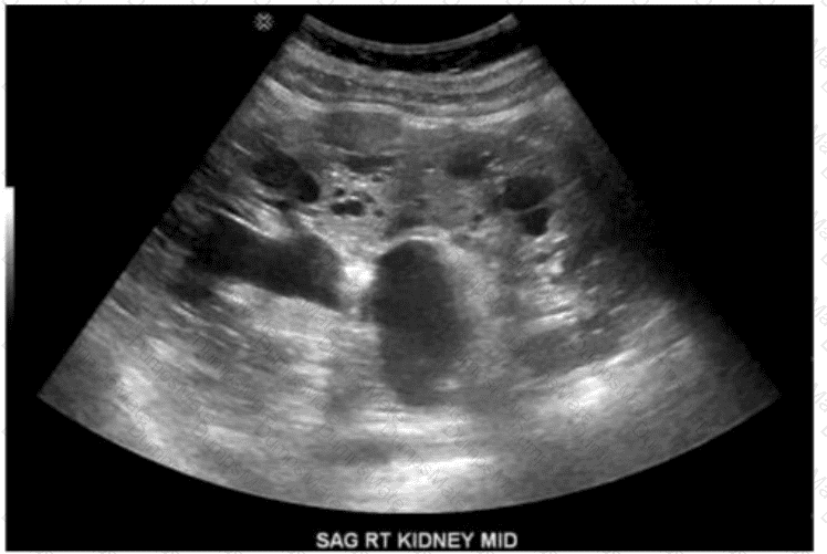 AB-Abdomen Question 29