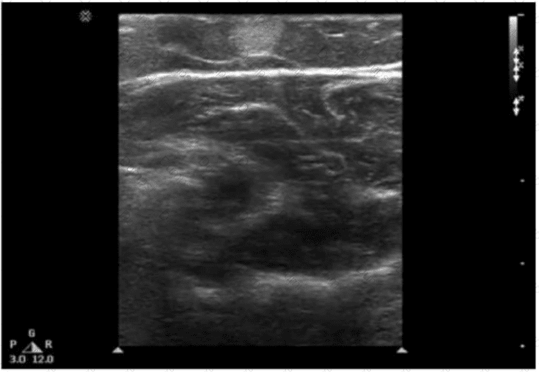 AB-Abdomen Question 13