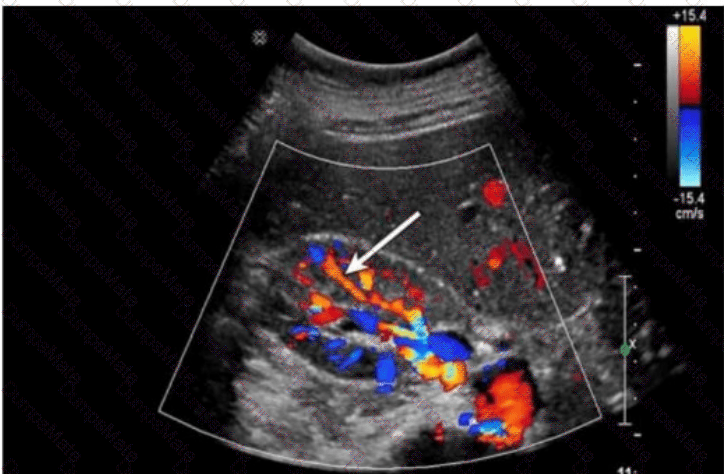 AB-Abdomen Question 35