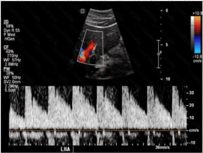 AB-Abdomen Question 36