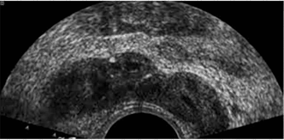 AB-Abdomen Question 43