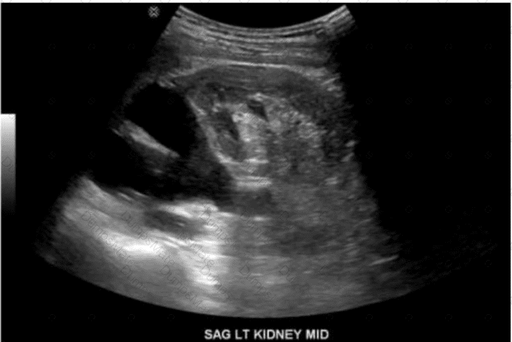 AB-Abdomen Question 25