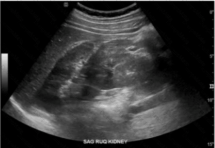 AB-Abdomen Question 24