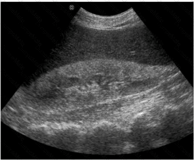 AB-Abdomen Question 13