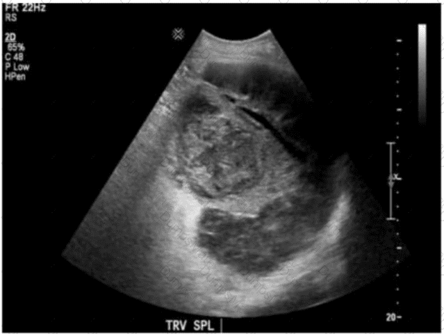 AB-Abdomen Question 11