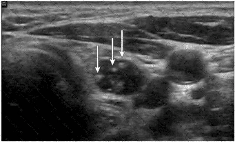 AB-Abdomen Question 6