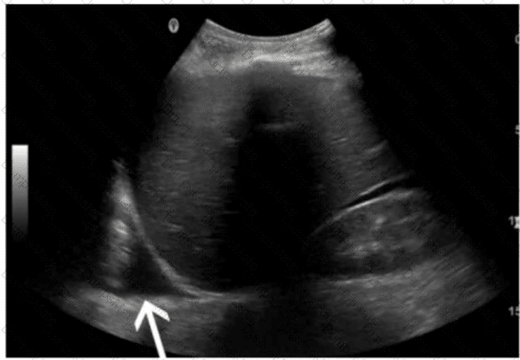 AB-Abdomen Question 27