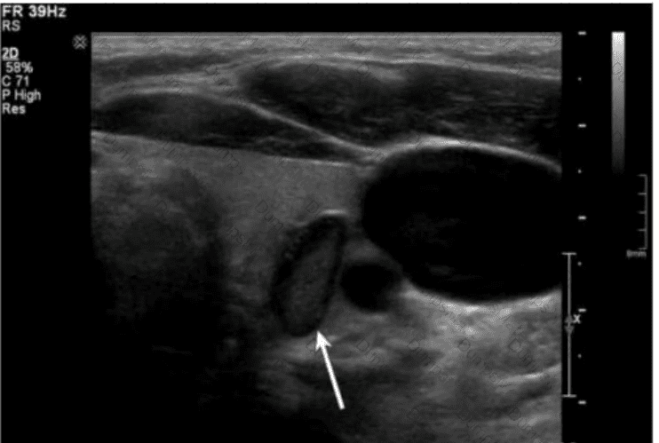 AB-Abdomen Question 48