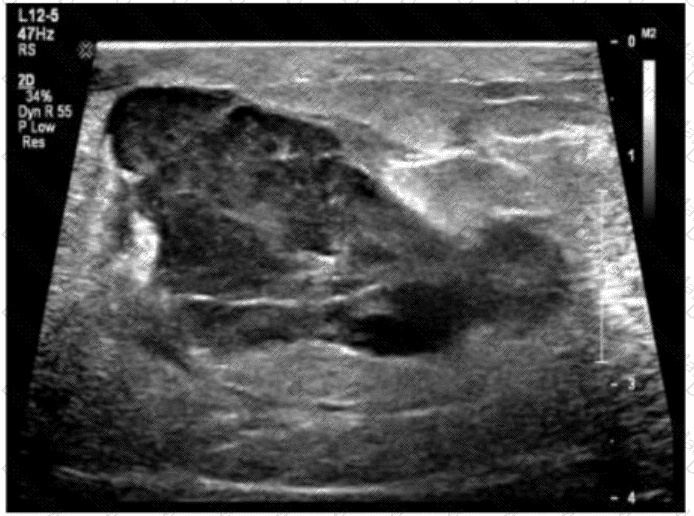 AB-Abdomen Question 8