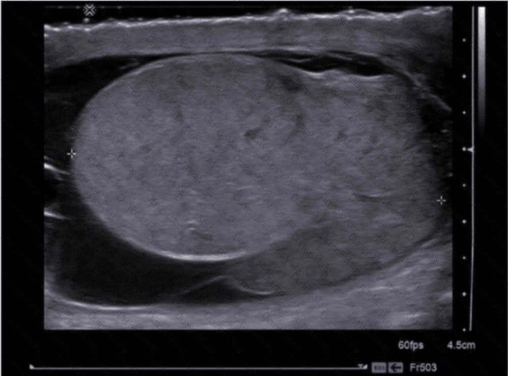 AB-Abdomen Question 33