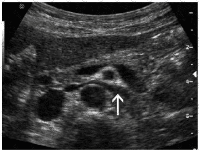 AB-Abdomen Question 39