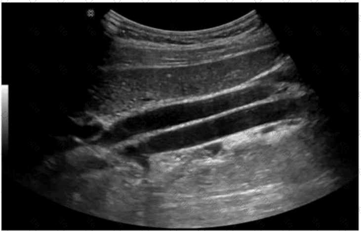 AB-Abdomen Question 12