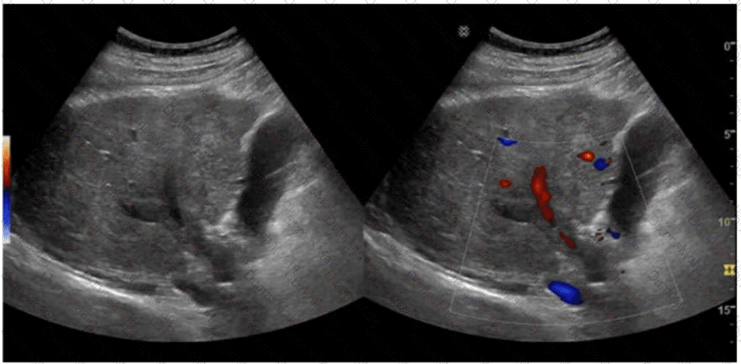 AB-Abdomen Question 11