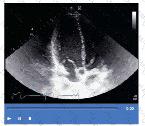 AE-Adult-Echocardiography Question 30