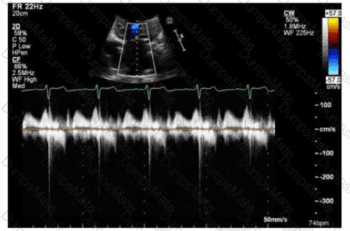 AE-Adult-Echocardiography Question 6