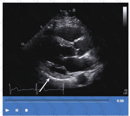 AE-Adult-Echocardiography Question 17