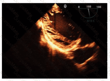 AE-Adult-Echocardiography Question 30