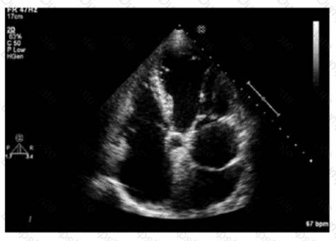 AE-Adult-Echocardiography Question 4