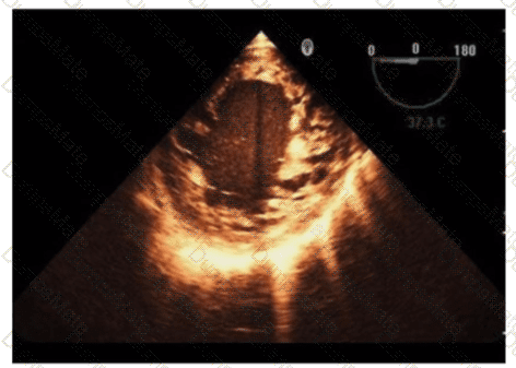AE-Adult-Echocardiography Question 30