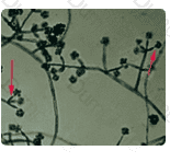 ASCP-MLT Question 37