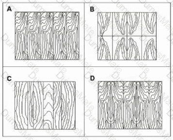 PDD Question 11